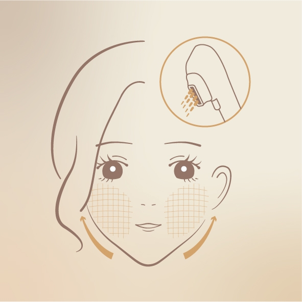 HIFU聚焦超聲波療程